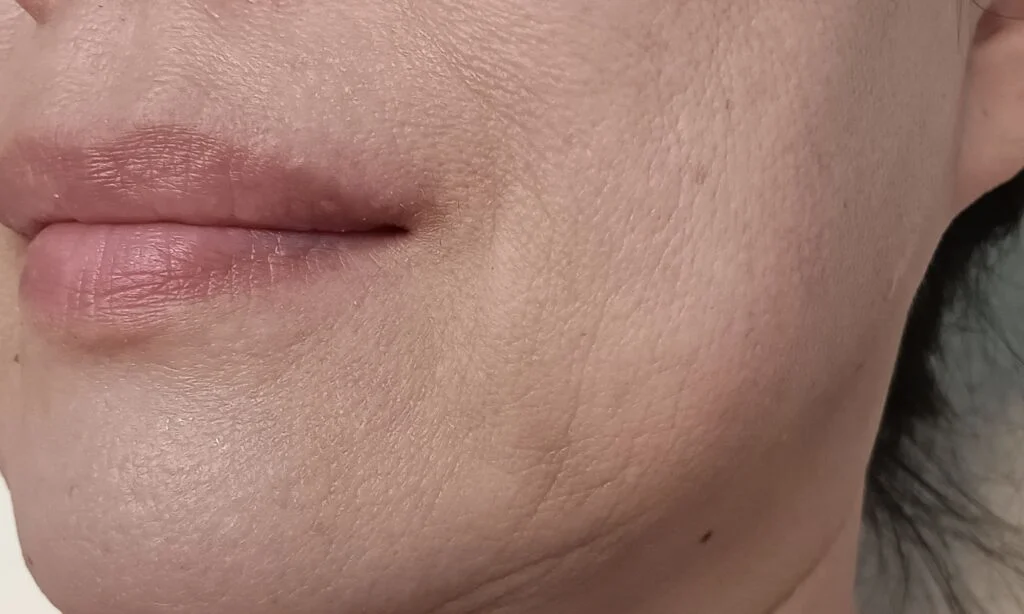 Close-up of natural vertical lip lines in woman over 40