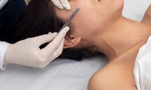 Dermaplaning: How It Improves Skin Texture, Makeup, and Skincare Results